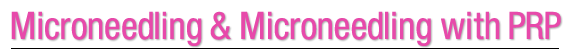 Microneedling & Microneedling with PRP