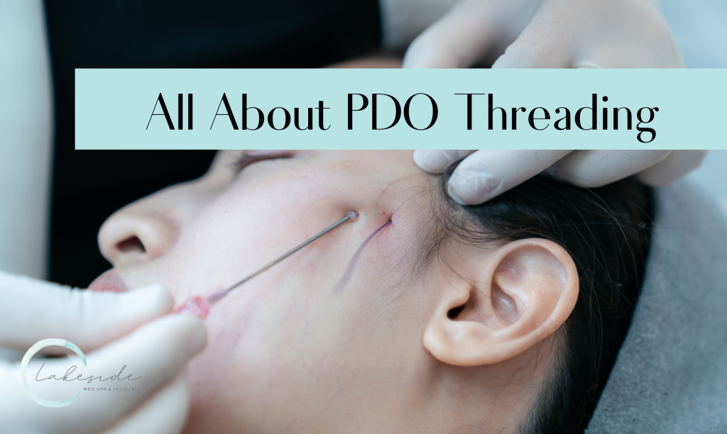All About PDO Threading Lakeside Med Spa & IV Lounge