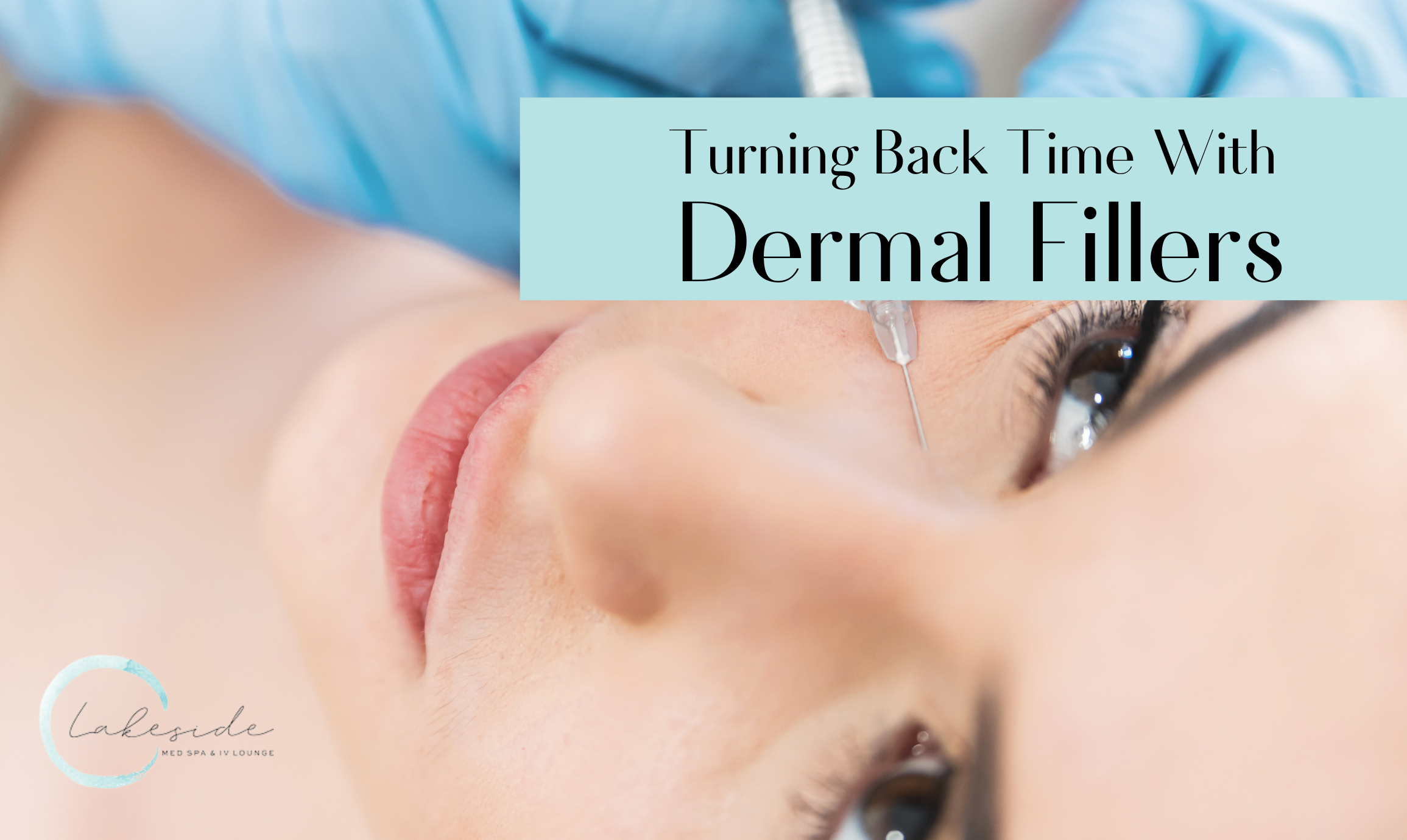 Turning Back Time With Dermal Fillers