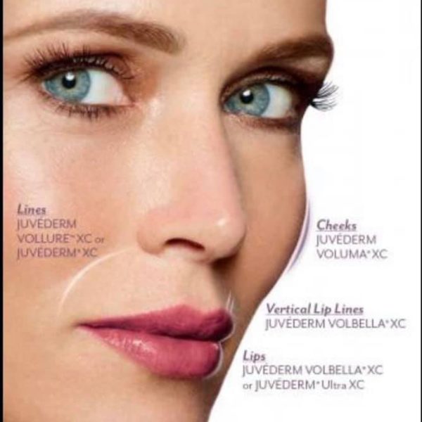 juvederm-difference-1