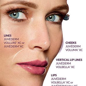 juvederm-difference